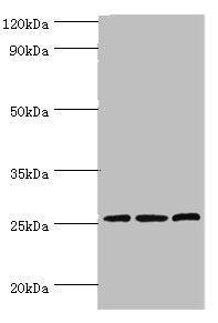 Western blot | All lanes: Claudin-14 antibody at 4μg/ml | Lane 1: Rat liver tissue | Lane 2: Mouse kidney tissue | Lane 3: Hela whole cell lysate | Secondary | Goat polyclonal to rabbit IgG at 1/10000 dilution | Predicted band size: 26 kDa | Observed band size: 26 kDa
