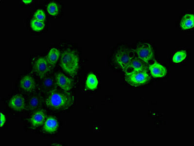 Immunofluorescent analysis of A431 cells using CLDN15 Antibody at dilution of 1:100 and Alexa Fluor 488-congugated AffiniPure Goat Anti-Rabbit IgG(H+L)Rabbit anti-Human CLDN15 Polyclonal Antibody