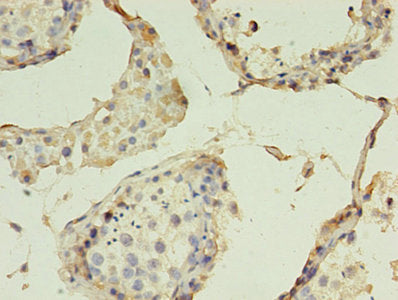Immunohistochemistry of paraffin-embedded human testis tissue using CLDN15 Antibody at dilution of 1:100Rabbit anti-Human CLDN15 Polyclonal Antibody