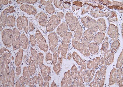 IHC image of CLDN18 Antibody diluted at 1:50 and staining in paraffin-embedded human stomach  tissue performed on a Leica BondTM system. After dewaxing and hydration, antigen retrieval was mediated by high pressure in a citrate buffer (pH 6.0). Section was blocked with 10% normal goat serum 30min at RT. Then primary antibody (1% BSA) was incubated at 4°C overnight. The primary is detected by a Goat anti-rabbit polymer IgG labeled by HRP and visualized using 0.05% DAB.Rabbit anti-Human CLDN18 Polyclonal Antibody