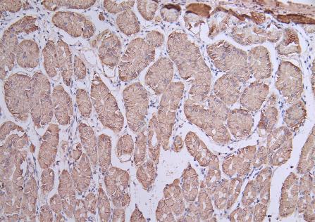 IHC image of CLDN18 Antibody diluted at 1:50 and staining in paraffin-embedded human stomach  tissue performed on a Leica BondTM system. After dewaxing and hydration, antigen retrieval was mediated by high pressure in a citrate buffer (pH 6.0). Section was blocked with 10% normal goat serum 30min at RT. Then primary antibody (1% BSA) was incubated at 4°C overnight. The primary is detected by a Goat anti-rabbit polymer IgG labeled by HRP and visualized using 0.05% DAB.Rabbit anti-Human CLDN18 Polyclonal Antibody