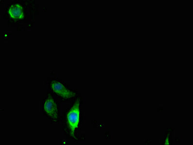 Immunofluorescent analysis of A549 cells using CLDN2 Antibody at dilution of 1:100 and Alexa Fluor 488-congugated AffiniPure Goat Anti-Rabbit IgG(H+L)Rabbit anti-Human CLDN2 Polyclonal Antibody