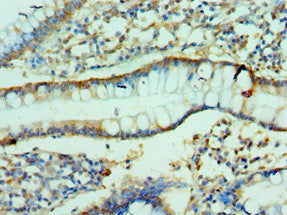 Immunohistochemistry of paraffin-embedded human small intestine tissue using the antibody at dilution of 1:100Rabbit anti-Human CLDN2 Polyclonal Antibody