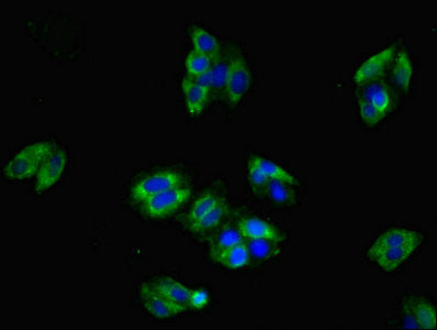 Immunofluorescent analysis of HepG2 cells using CLDN8 Antibody at dilution of 1:100 and Alexa Fluor 488-congugated AffiniPure Goat Anti-Rabbit IgG(H+L)Rabbit anti-Human CLDN8 Polyclonal Antibody