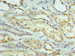 Immunohistochemistry of paraffin-embedded human kidney tissue using CLDN8 Antibody at dilution of 1:100Rabbit anti-Human CLDN8 Polyclonal Antibody