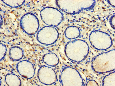 Immunohistochemistry of paraffin-embedded human stomach tissue using CLEC18A Antibody at dilution of 1:100Rabbit anti-Human CLEC18A Polyclonal Antibody