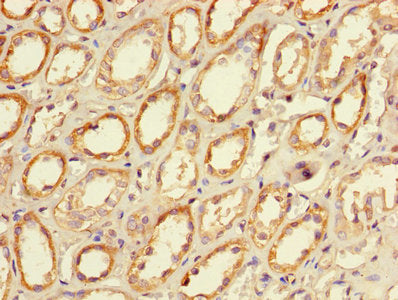 Immunohistochemistry of paraffin-embedded human kidney tissue using CLEC18A Antibody at dilution of 1:100Rabbit anti-Human CLEC18A Polyclonal Antibody