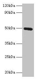 Western blot  | All lanes: CLEC18A antibody at 2µg/ml + Mouse stomach tissue  | Secondary  | Goat polyclonal to rabbit IgG at 1/10000 dilution  | Predicted band size: 50, 12 kDa  | Observed band size: 50 kDaRabbit anti-Human CLEC18A Polyclonal Antibody