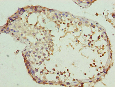 Immunohistochemistry of paraffin-embedded human testis tissue using CLGN Antibody at dilution of 1:100Rabbit anti-Human CLGN Polyclonal Antibody