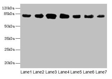 Western blot  | All lanes: CLGN antibody at 7µg/ml  | Lane 1: Mouse brain tissue  | Lane 2: Mouse lung tissue  | Lane 3: Jurkat whole cell lysate  | Lane 4: HepG2 whole cell lysate  | Lane 5: PC-3 whole cell lysate  | Lane 6: Hela whole cell lysate  | Lane 7: HL60 whole cell lysate  | Secondary  | Goat polyclonal to rabbit IgG at 1/10000 dilution  | Predicted band size: 71, 47 kDa  | Observed band size: 80 kDaRabbit anti-Human CLGN Polyclonal Antibody