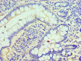Immunohistochemistry of paraffin-embedded human small intestine tissue using CLIC1 Antibody at dilution of 1:100Rabbit anti-Human CLIC1 Polyclonal Antibody
