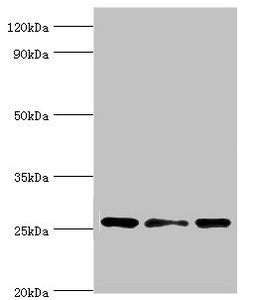 Western blot | All lanes: Chloride intracellular channel protein 1 antibody at 4μg/ml | Lane 1: Hela whole cell lysate | Lane 2: Jurkat whole cell lysate | Lane 3: MCF-7 whole cell lysate | Secondary | Goat polyclonal to rabbit IgG at 1/10000 dilution | Predicted band size: 27 kDa | Observed band size: 27 kDaRabbit anti-Human CLIC1 Polyclonal Antibody