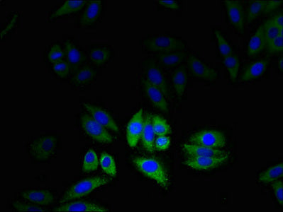 Immunofluorescent analysis of HepG2 cells using CLIC2 Antibody at dilution of 1:100 and Alexa Fluor 488-congugated AffiniPure Goat Anti-Rabbit IgG(H+L)Rabbit anti-Human CLIC2 Polyclonal Antibody
