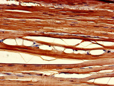 Immunohistochemistry of paraffin-embedded human skeletal muscle tissue using the antibody at dilution of 1:100Rabbit anti-Human CLIC2 Polyclonal Antibody