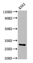 Western Blot  | Positive WB detected in: K562 whole cell lysate  | All lanes: CLIC2 antibody at 2µg/ml  | Secondary  | Goat polyclonal to rabbit IgG at 1/50000 dilution  | Predicted band size: 29 kDa  | Observed band size: 29 kDaRabbit anti-Human CLIC2 Polyclonal Antibody