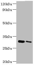 Western blot | All lanes: Chloride intracellular channel protein 4 antibody at 5μg/ml | Lane 1: Mouse kidney tissue | Lane 2: Mouse ovarian tissue | Secondary | Goat polyclonal to rabbit IgG at 1/10000 dilution | Predicted band size: 29 kDa | Observed band size: 29 kDaRabbit anti-Human CLIC4 Polyclonal Antibody