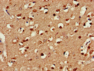 Immunohistochemistry of paraffin-embedded human brain tissue using CLINT1 Antibody at dilution of 1:100Rabbit anti-Human CLINT1 Polyclonal Antibody