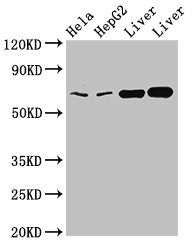 Western Blot | Positive WB detected in: Hela whole cell lysate, HepG2 whole cell lysate, Rat liver tissue, Mouse liver tissue | All lanes: CLINT1 antibody at 2μg/ml | Secondary | Goat polyclonal to rabbit IgG at 1/50000 dilution | Predicted band size: 69, 71 kDa | Observed band size: 69 kDaRabbit anti-Human CLINT1 Polyclonal Antibody