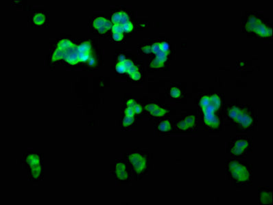 Immunofluorescence staining of 293T cells with CLN5 Antibody at 1:100, counter-stained with DAPI. The cells were fixed in 4% formaldehyde, permeabilized using 0.2% Triton X-100 and blocked in 10% normal Goat Serum. The cells were then incubated with the antibody overnight at 4°C. The secondary antibody was Alexa Fluor 488-congugated AffiniPure Goat Anti-Rabbit IgG(H+L).Rabbit anti-Human CLN5 Polyclonal Antibody