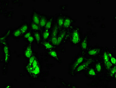 Immunofluorescent analysis of Hela cells using CLOCK Antibody at dilution of 1:100 and Alexa Fluor 488-congugated AffiniPure Goat Anti-Rabbit IgG(H+L)Rabbit anti-Human CLOCK Polyclonal Antibody