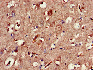 Immunohistochemistry of paraffin-embedded human brain tissue using CLOCK Antibody at dilution of 1:100Rabbit anti-Human CLOCK Polyclonal Antibody