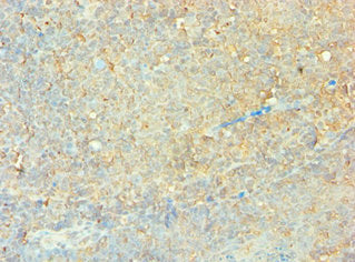 Immunohistochemistry of paraffin-embedded human tonsil tissue using CLOCK Antibody at dilution of 1:100Rabbit anti-Human CLOCK Polyclonal Antibody