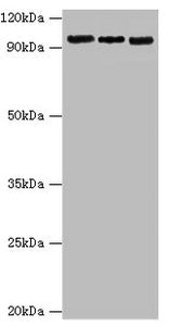 Western blot | All lanes: Circadian locomoter output cycles protein kaput antibody at 6μg/ml | Lane 1: Hela whole cell lysate | Lane 2: NIH/3T3 whole cell lysate | Lane 3: 293T whole cell lysate | Secondary | Goat polyclonal to rabbit IgG at 1/10000 dilution | Predicted band size: 95 kDa | Observed band size: 95 kDaRabbit anti-Human CLOCK Polyclonal Antibody