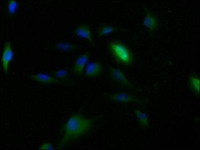 Immunofluorescence staining of U251 cells with CLRN2 Antibody at 1:150, counter-stained with DAPI. The cells were fixed in 4% formaldehyde, permeabilized using 0.2% Triton X-100 and blocked in 10% normal Goat Serum. The cells were then incubated with the antibody overnight at 4°C. The secondary antibody was Alexa Fluor 488-congugated AffiniPure Goat Anti-Rabbit IgG(H+L).Rabbit anti-Human CLRN2 Polyclonal Antibody