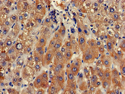 Immunohistochemistry of paraffin-embedded human liver tissue using the antibody at dilution of 1:100Rabbit anti-Human CLRN2 Polyclonal Antibody