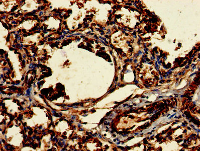 Immunohistochemistry of paraffin-embedded human lung tissue using CLRN2 Antibody at dilution of 1:100Rabbit anti-Human CLRN2 Polyclonal Antibody