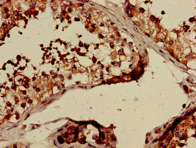 Immunohistochemistry of paraffin-embedded human testis tissue using CLTCL1 Antibody at dilution of 1:100Rabbit anti-Human CLTCL1 Polyclonal Antibody