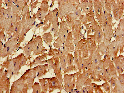 Immunohistochemistry of paraffin-embedded human heart tissue using CLTCL1 Antibody at dilution of 1:100Rabbit anti-Human CLTCL1 Polyclonal Antibody