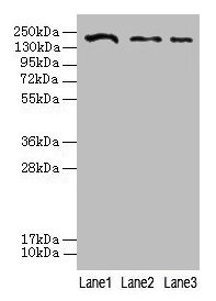 Western blot  | All lanes: CLTCL1 antibody at 2µg/ml  | Lane 1: Jurkat whole cell lysate  | Lane 2: NIH/3T3 whole cell lysate  | Lane 3: A431 whole cell lysate  | Secondary  | Goat polyclonal to rabbit IgG at 1/10000 dilution  | Predicted band size: 188, 181 kDa  | Observed band size: 188 kDaRabbit anti-Human CLTCL1 Polyclonal Antibody