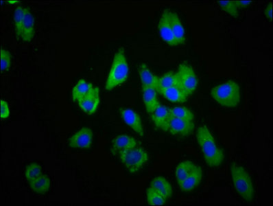 Immunofluorescence staining of HepG2 cells with CMKLR1 Antibody at 1:100, counter-stained with DAPI. The cells were fixed in 4% formaldehyde, permeabilized using 0.2% Triton X-100 and blocked in 10% normal Goat Serum. The cells were then incubated with the antibody overnight at 4°C. The secondary antibody was Alexa Fluor 488-congugated AffiniPure Goat Anti-Rabbit IgG(H+L).Rabbit anti-Human CMKLR1 Polyclonal Antibody