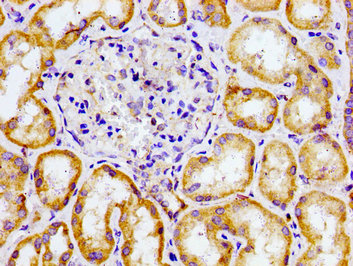 Immunohistochemistry of paraffin-embedded human kidney tissue using the antibody at dilution of 1:100Rabbit anti-Human CMKLR1 Polyclonal Antibody