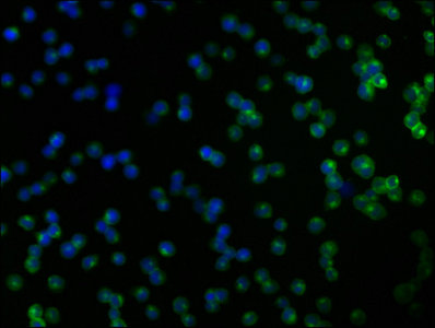 Immunofluorescence staining of Jurkat cells with CNKSR2 Antibody at 1:166, counter-stained with DAPI. The cells were fixed in 4% formaldehyde, permeabilized using 0.2% Triton X-100 and blocked in 10% normal Goat Serum. The cells were then incubated with the antibody overnight at 4°C. The secondary antibody was Alexa Fluor 488-congugated AffiniPure Goat Anti-Rabbit IgG(H+L).Rabbit anti-Human CNKSR2 Polyclonal Antibody