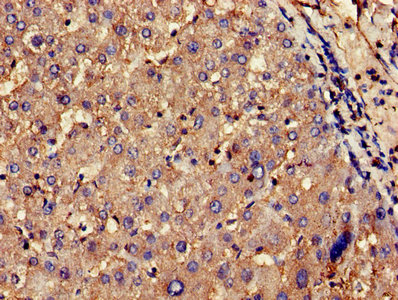 Immunohistochemistry of paraffin-embedded human liver tissue using the antibody at dilution of 1:100Rabbit anti-Human CNKSR2 Polyclonal Antibody
