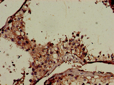 Immunohistochemistry of paraffin-embedded human testis tissue using CNKSR2 Antibody at dilution of 1:100Rabbit anti-Human CNKSR2 Polyclonal Antibody
