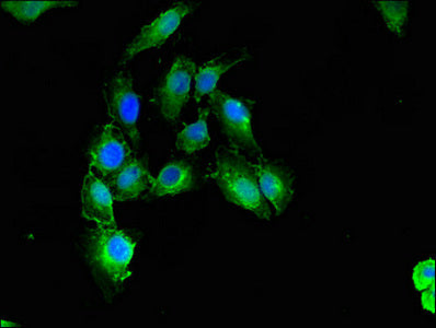 Immunofluorescent analysis of Hela cells using CNN3 Antibody at dilution of 1:100 and Alexa Fluor 488-congugated AffiniPure Goat Anti-Rabbit IgG(H+L)Rabbit anti-Human CNN3 Polyclonal Antibody
