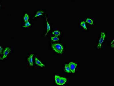 Immunofluorescent analysis of HepG2 cells using CNR2 Antibody at dilution of 1:100 and Alexa Fluor 488-congugated AffiniPure Goat Anti-Rabbit IgG(H+L)Rabbit anti-Human CNR2 Polyclonal Antibody