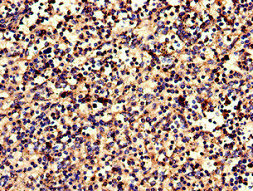 Immunohistochemistry of paraffin-embedded human spleen tissue using the antibody at dilution of 1:100Rabbit anti-Human CNR2 Polyclonal Antibody