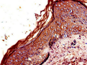 Immunohistochemistry of paraffin-embedded human skin tissue using CNR2 Antibody at dilution of 1:100Rabbit anti-Human CNR2 Polyclonal Antibody