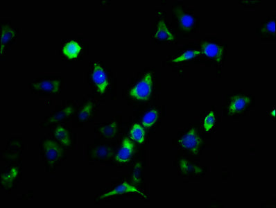 Immunofluorescence staining of SH-SY5Y cells with the antibody at 1:133, counter-stained with DAPI. The cells were fixed in 4% formaldehyde, permeabilized using 0.2% Triton X-100 and blocked in 10% normal Goat Serum. The cells were then incubated with the antibody overnight at 4°C. The secondary antibody was Alexa Fluor 488-congugated AffiniPure Goat Anti-Rabbit IgG(H+L).Rabbit anti-Human CNTFR Polyclonal Antibody