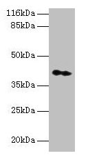 Western blot  | All lanes: CNTFR antibody at 2µg/ml + Hela whole cell lysate  | Secondary  | Goat polyclonal to rabbit IgG at 1/10000 dilution  | Predicted band size: 41 kDa  | Observed band size: 41 kDaRabbit anti-Human CNTFR Polyclonal Antibody