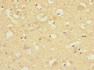 Immunohistochemistry of paraffin-embedded human brain tissue using CNTNAP1 Antibody at dilution of 1:100Rabbit anti-Human CNTNAP1 Polyclonal Antibody
