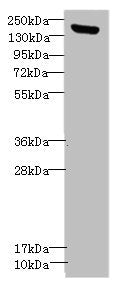 Western blot | All lanes: CNTNAP1antibody IgG at 1.36μg/ml + Mouse brain tissue | Secondary | Goat polyclonal to rabbit IgG at 1/10000 dilution | Predicted band size: 156 kDa | Observed band size: 156 kDaRabbit anti-Human CNTNAP1 Polyclonal Antibody