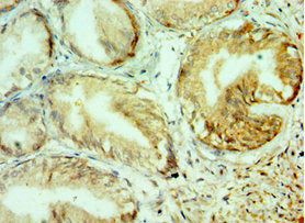 Immunohistochemistry of paraffin-embedded human prostate tissue using COL10A1 Antibody at dilution of 1:100Rabbit anti-Human COL10A1 Polyclonal Antibody