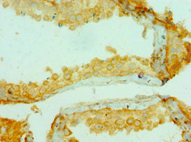 Immunohistochemistry of paraffin-embedded human testis tissue using COL10A1 Antibody at dilution of 1:100Rabbit anti-Human COL10A1 Polyclonal Antibody