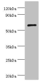Western blot  | All lanes: COL10A1 antibody at 4µg/ml + K562 whole cell lysate  | Secondary  | Goat polyclonal to rabbit IgG at 1/10000 dilution  | Predicted band size: 66 kDa  | Observed band size: 66 kDaRabbit anti-Human COL10A1 Polyclonal Antibody