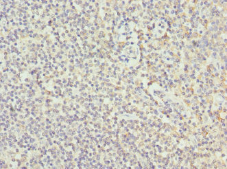 Immunohistochemistry of paraffin-embedded human tonsil tissue using COL9A3 Antibody at dilution of 1:100Rabbit anti-Human COL9A3 Polyclonal Antibody